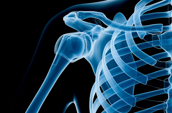 Squelette et maladie des os - consultation médicale par vidéo